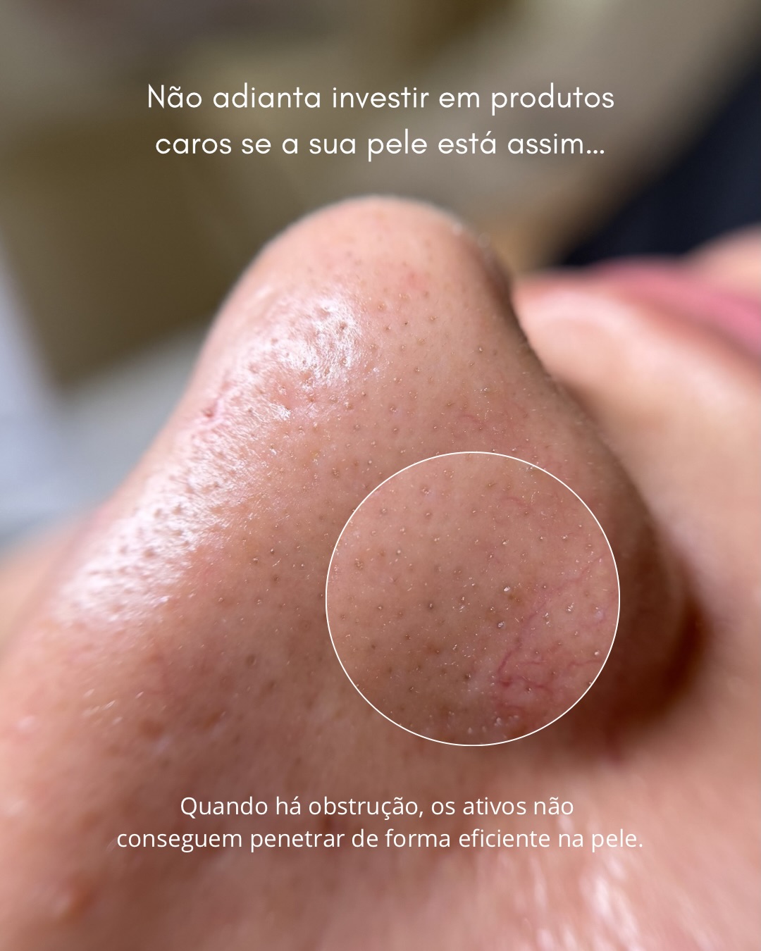 Limpeza de Pele